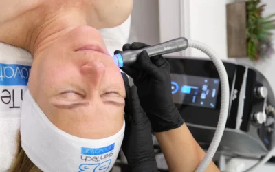 Aquafacial près de Troyes : nettoyage profond et infusion d’actifs pour une peau purifiée